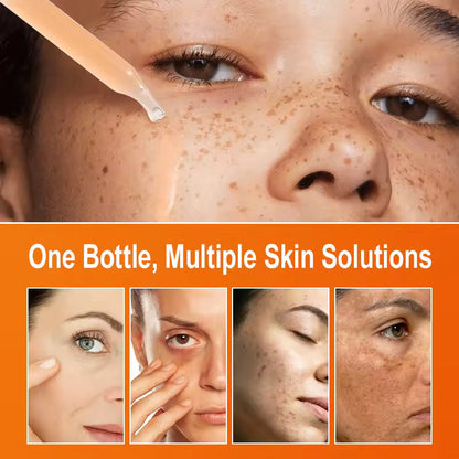 Vitamin C Serum 30ml – Brightening, Dark Spot & Glow Support